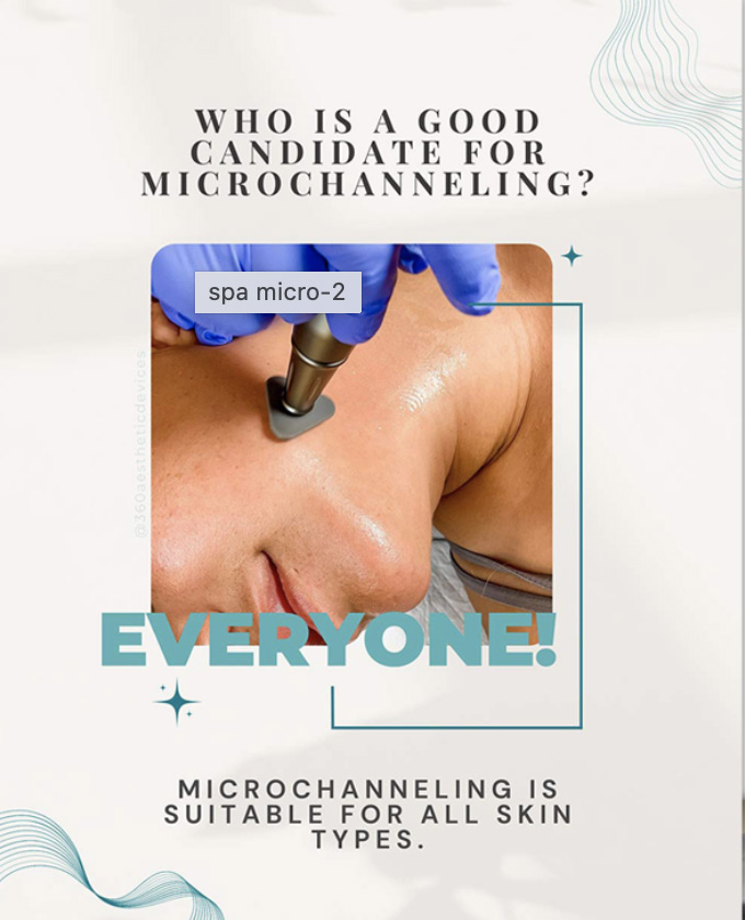 Image for Microchanneling