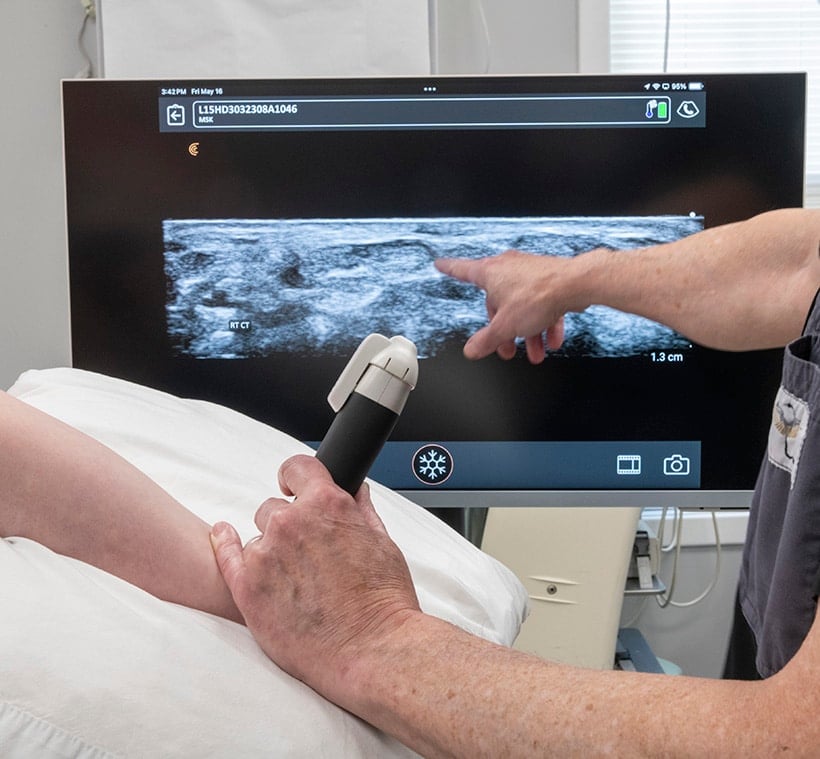 ultrasound